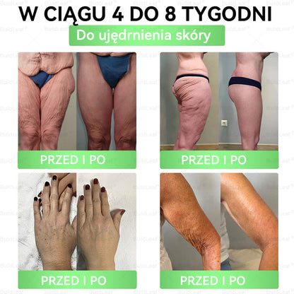 🎁 Zostało tylko 5 pudełek! Oferujemy dodatkowe 50% zniżki! Bądź zdrowy i w dobrej formie. Schudnij teraz i oszczędzaj na przyszły rok.